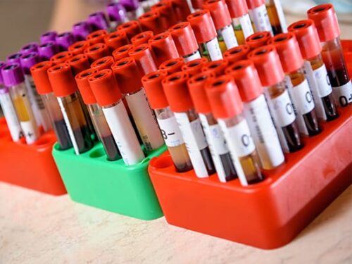 biofluids Biofluids amsbio