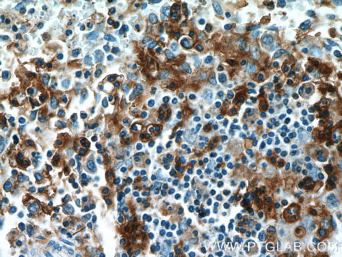 Leukemia ITGAX Antibody