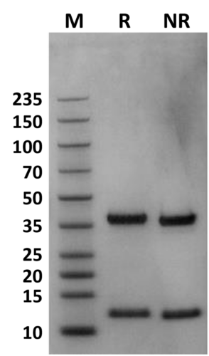 Their Human FcRn (FCGRT-B2M) heterodimer protein: DS-PAGE