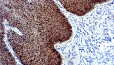 p16 p16 Diagnostic BioSystems