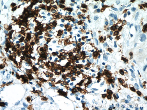 Leukemia CD3E Antibody