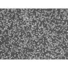 Human Lymphatic Mononuclear Cells 10 million cells in 1 ml volume