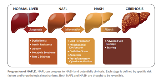 The threat of NASH / NAFLD The threat of NASH / NAFLD