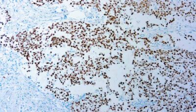 SALL4 SALL4 antibody DBS