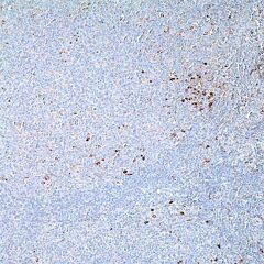 A-1 Antitrypsin, polyclonal, rabbit, concentrate