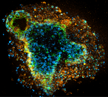 exampleIF1-350x315 3D cell culture example